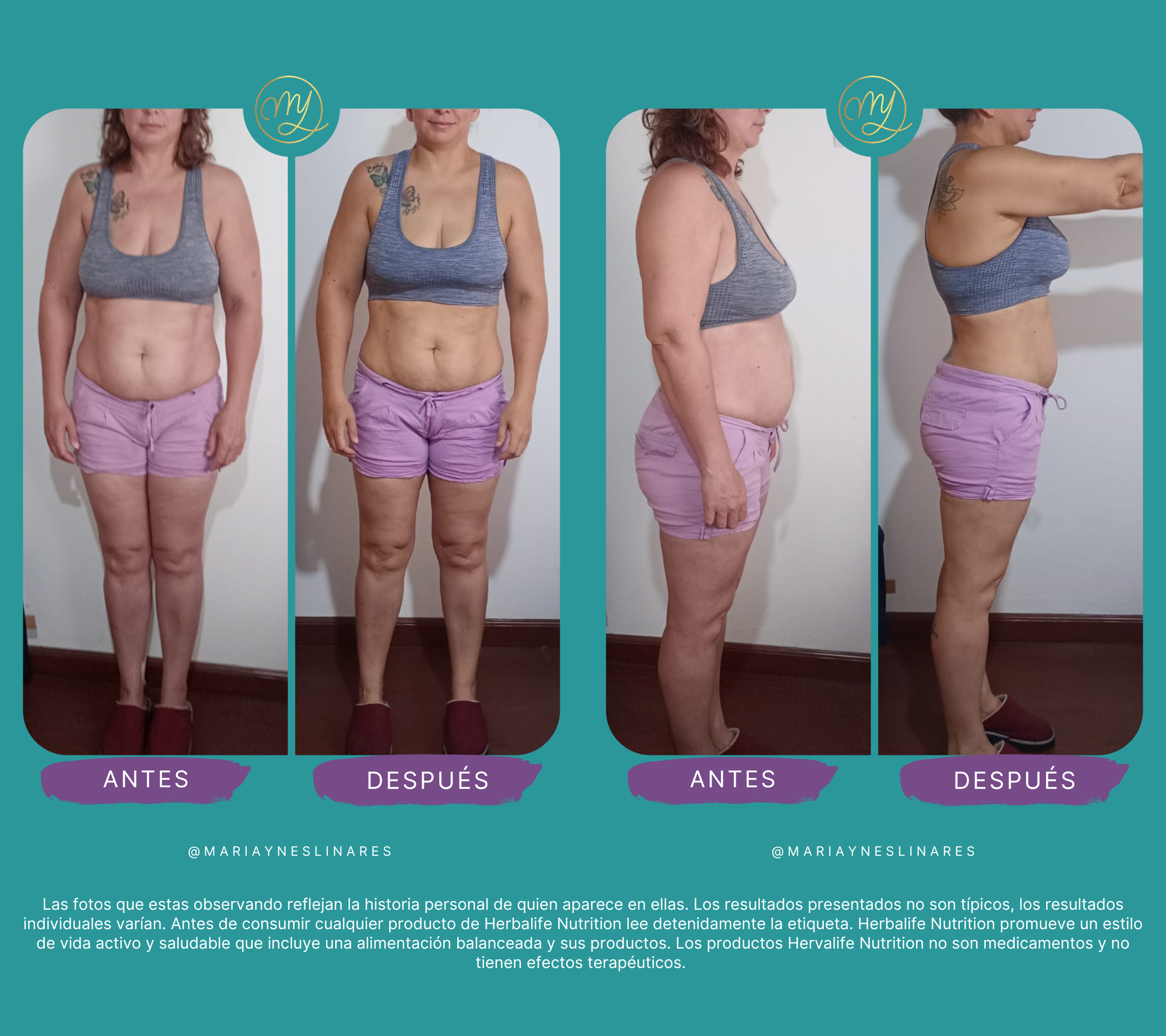 Resultado de Jessi — antes y después